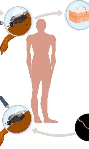 12011333-Onchoceraiasis-Lifecycle - Copie